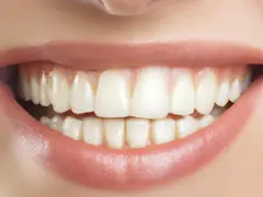 Sağlıklı diş bakımı